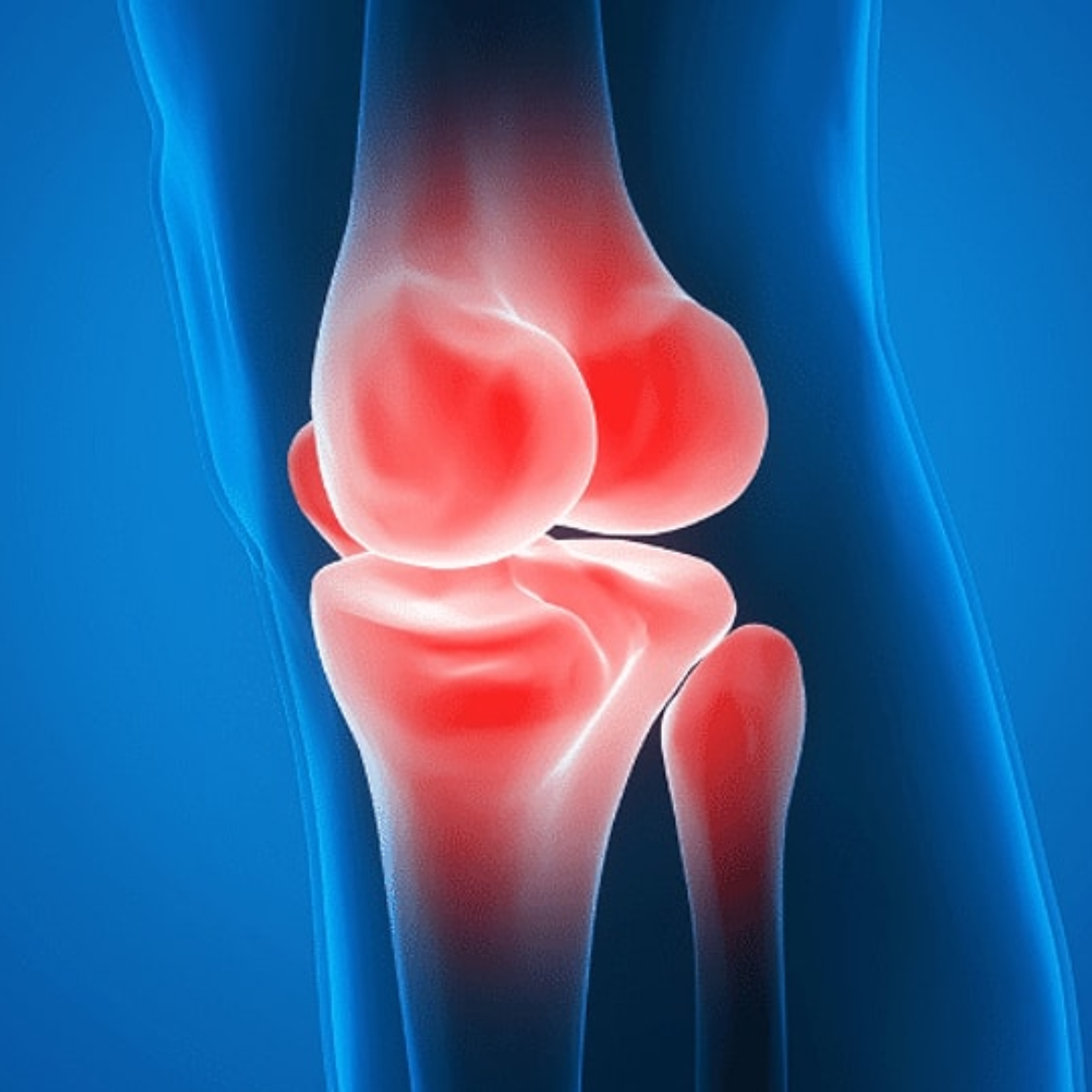 Knee Treatment & Surgery in Pune | Dr. Vishal Patil – Orthopedic Specialist Dr. Vishal Patil performing advanced knee surgery in Pune, specializing in knee replacement and arthroscopic knee treatment.