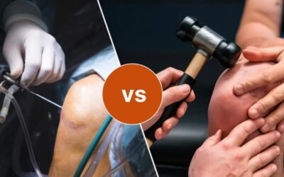 Robotic Knee Replacement vs Traditional Surgery – Dr. Vishal Patil Comparison of robotic and traditional knee replacement surgery